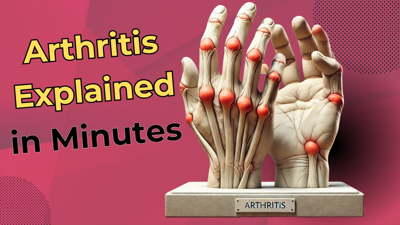 Arthritis: A Comprehensive Guide to Understanding, Prevention, and Treatment