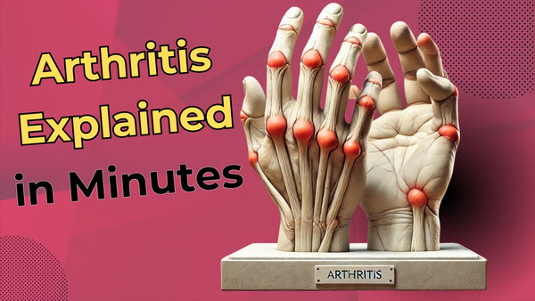 Arthritis: A Comprehensive Guide to Understanding, Prevention, and Treatment