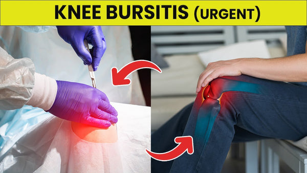 5 Knee Bursitis Symptoms You Need to Know (could be urgent)